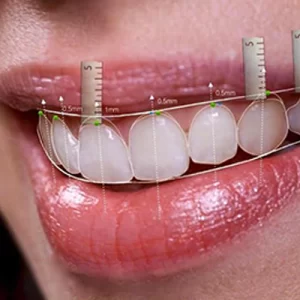 Estetik Diş Hekimliği