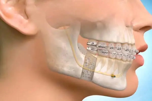 Ağız Diş ve Çene Cerrahisi